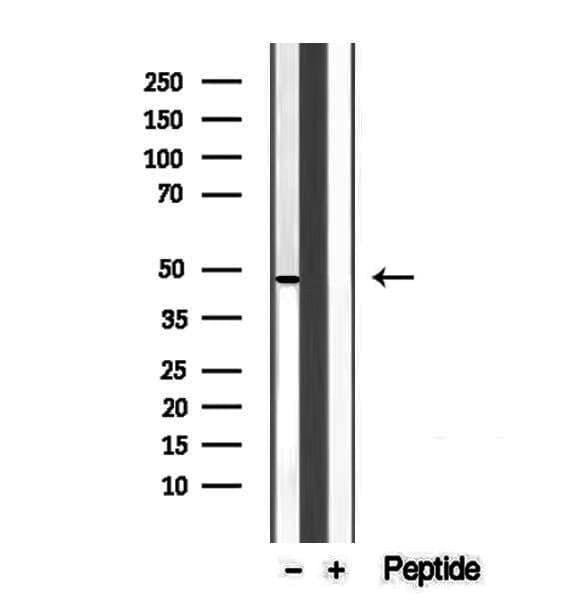 Polyclonal Rabbit anti-Human UQCRC1 Antibody (IHC, IF, WB)