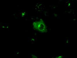 APP / Beta Amyloid Precursor Antibody (clone OTI6B7)