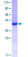 Human KCNJ1 / ROMK Protein (Recombinant GST, N-terminus)