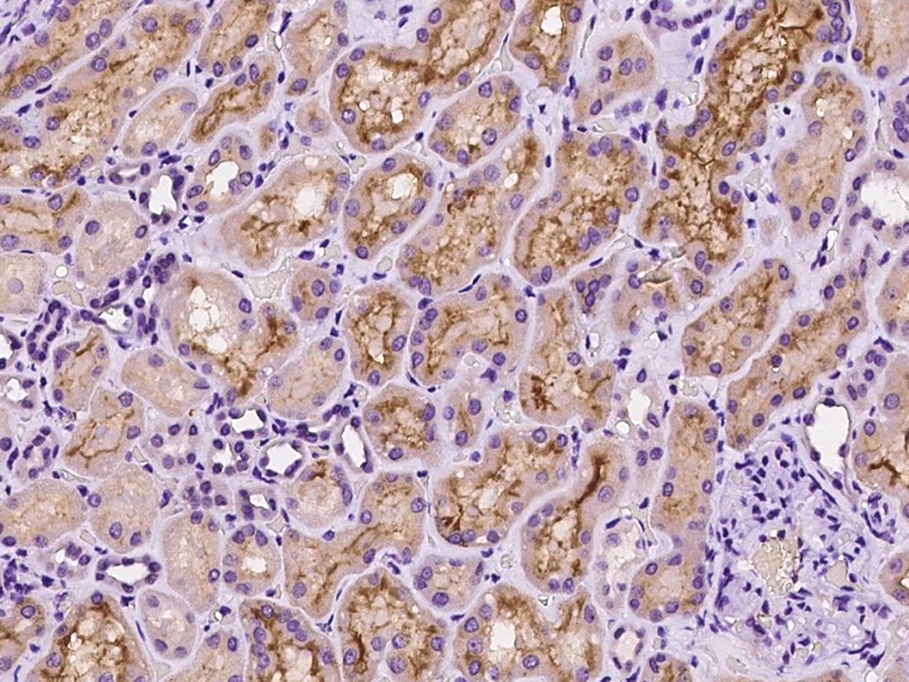 TAOK3 / JIK Antibody