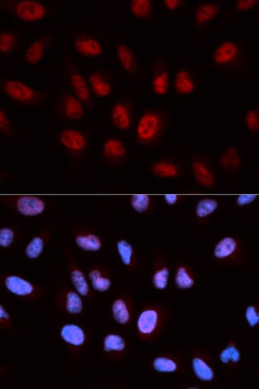 Polyclonal Rabbit anti-Human AICAR / ATIC Antibody (IHC, IF, WB)
