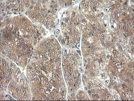 ALS2CR1 / NIF3L1 Antibody (clone OTI2B7)