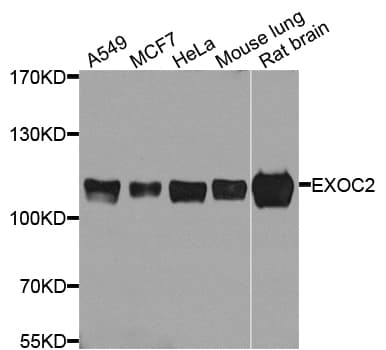 Polyclonal Rabbit anti-Human EXOC2 / SEC5 Antibody (WB)