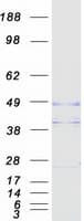 Human OPTC / Opticin Protein (Recombinant Myc-DDK (Flag))