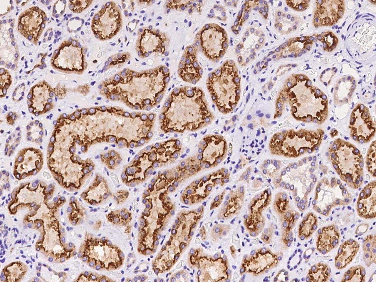 AMN Antibody