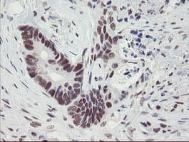 Monoclonal Mouse anti-Human TPRKB Antibody (clone OTI1E9, IHC, WB)