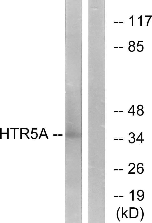 HTR5A / 5-HT5A Receptor Antibody (aa15-64)