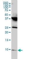 IHC-plus™ Monoclonal Mouse anti-Human RPL39L Antibody (clone 4A8-1B6, IHC, WB)