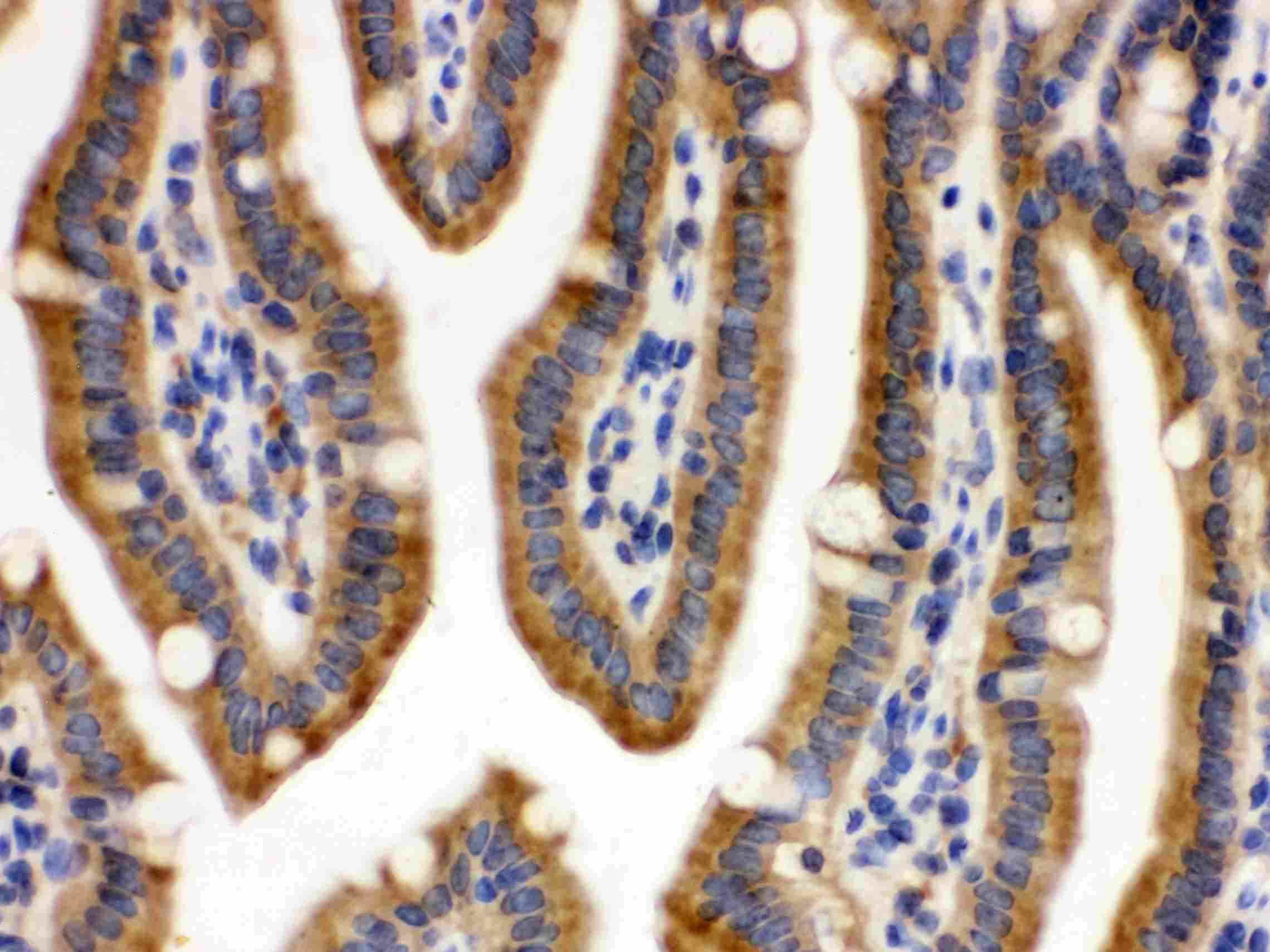 CDCP1 Antibody