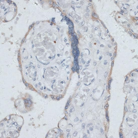 DTNBP1 / Dysbindin Antibody