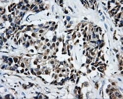 Monoclonal Mouse anti-Human LOX / Lysyl Oxidase Antibody (clone OTI6B11, IHC, IF, WB)
