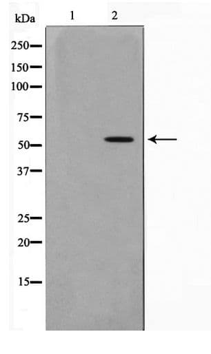 PKNOX2 Antibody