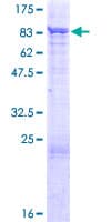 Human PIAS2 / PIASX Protein (Recombinant GST)