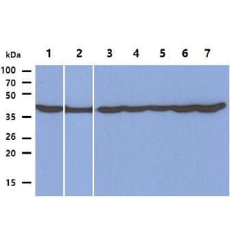 PGK1 / Phosphoglycerate Kinase Antibody (clone AT2F4)