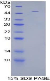 Mouse EMA / MUC1 Protein (Recombinant His-GST)