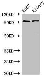 Polyclonal Rabbit anti-Human ARG1 / Arginase 1 Antibody (IHC, WB)