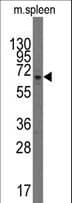 PARP3 Antibody (aa451-481)