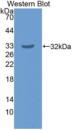 HSD17B14 Antibody (aa1-270, PE)