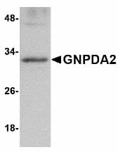 IHC-plus™ GNPDA2 Antibody