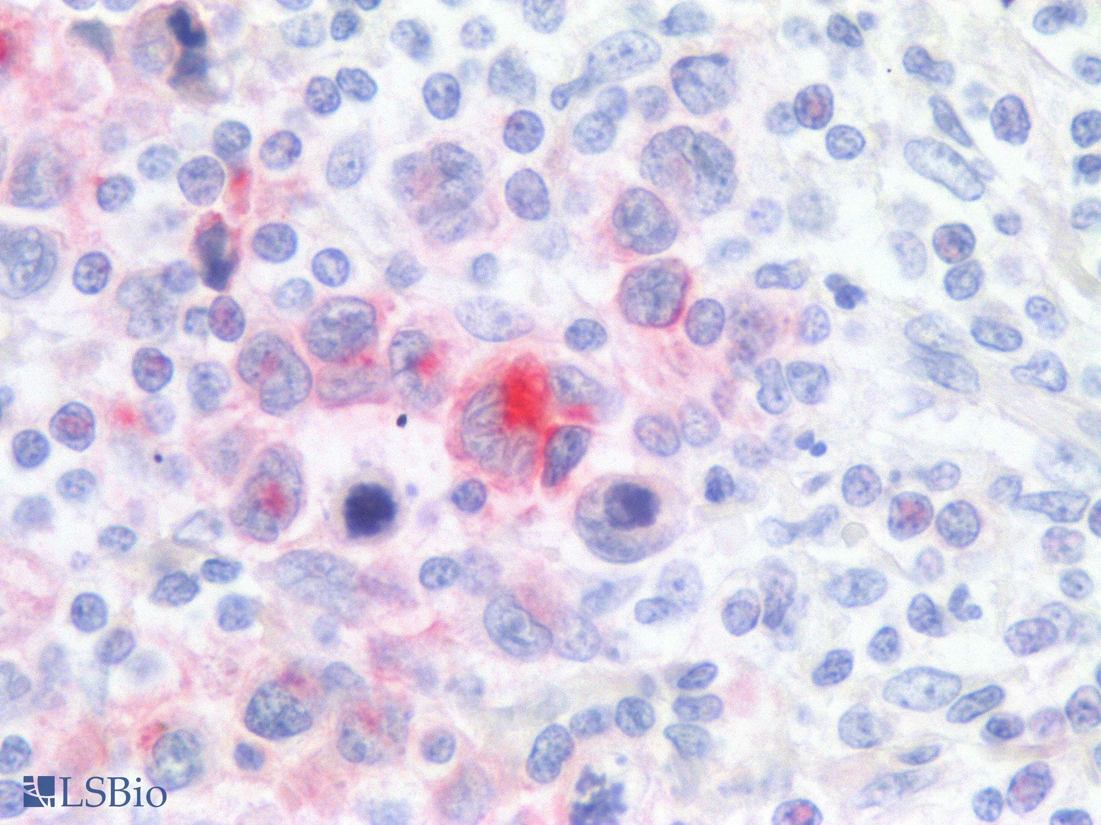 PathPlus™ Recombinant Monoclonal Rabbit anti-Human CD30 Antibody (clone Ki-1/1505R, IHC)