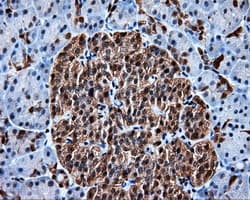 Heat Shock Protein 70 / HSPA1A Antibody (clone OTI3G9)