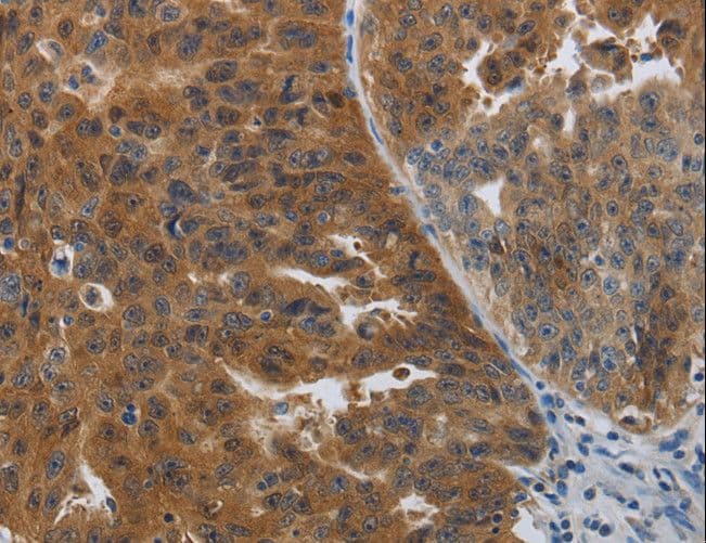 PDCD2 Antibody