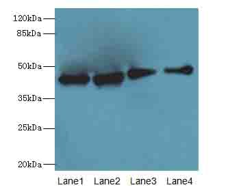 Polyclonal Rabbit anti-Human LYAR Antibody (IHC, WB)
