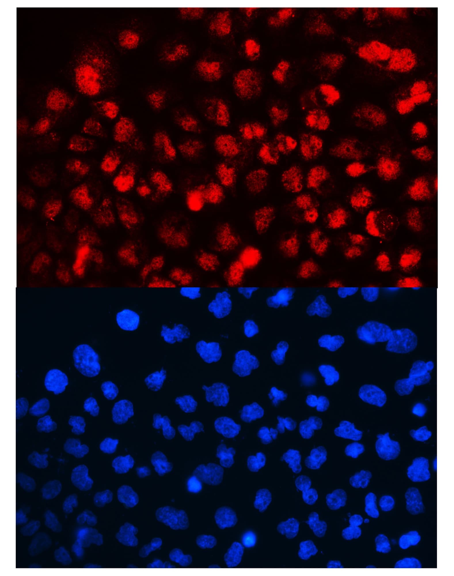 CCNT1 / Cyclin T1 Antibody