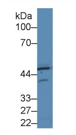 EIF2AK2 / PKR Antibody (aa279-506, Biotin)