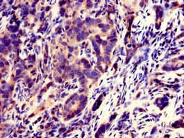 SPATC1L / C21orf56 Antibody