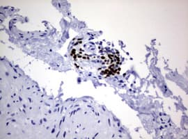 PAX5 Antibody (clone OTI3A7)