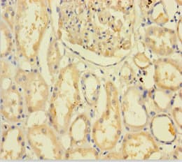 C9orf72 / ALSFTD Antibody