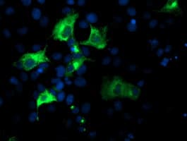 NUCB1 / Nucleobindin Antibody (clone OTI1A5)