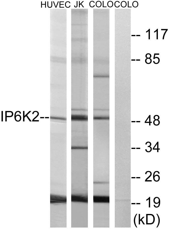 IHC-plus™ IP6K2 Antibody (aa161-210)
