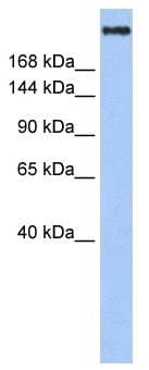 Polyclonal Rabbit anti-Human CREBBP / CREB Binding Protein Antibody (aa144-193, IHC, WB)