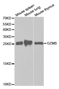 Polyclonal Rabbit anti-Human GZMB / Granzyme B Antibody (IF, WB)