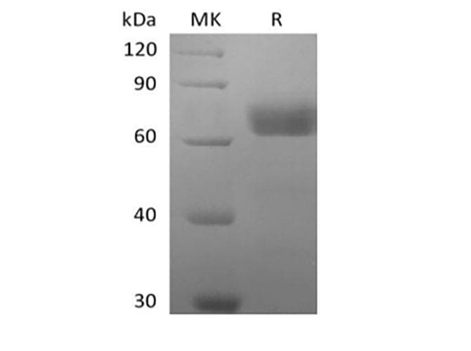 Human BTN2A2 Protein (Recombinant Fc-AVI, C-terminus)