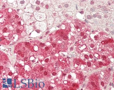 IHC-plus™ Polyclonal Rabbit anti-Human DHAND / HAND2 Antibody (IHC, IF, WB)