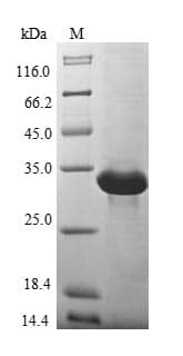 Mouse MUT / MCM Protein (Recombinant 6His, N-terminus)
