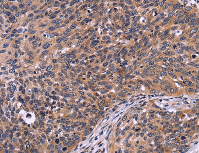 LCA3 / SPATA7 Antibody