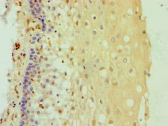 DDX3 / DDX3X Antibody (aa1-220)