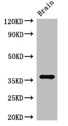 RNF126 Antibody (aa39-225)