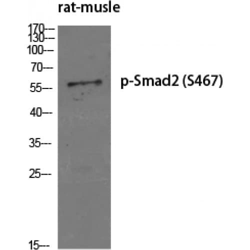 SMAD2 Antibody (410-490 aa)