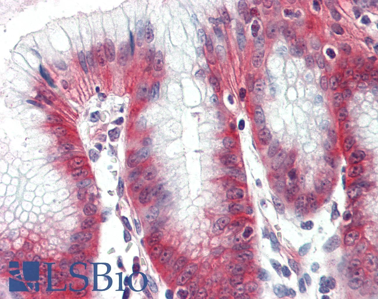 IHC-plus™ SLC12A2 / NKCC1 Antibody (Internal)