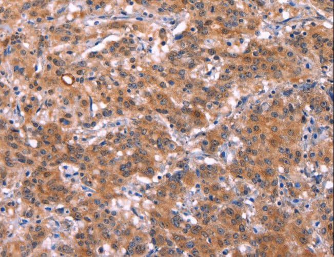 Polyclonal Rabbit anti-Human HMGCS1 / HMG-CoA Synthase 1 Antibody (IHC, WB)