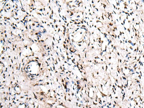 ZNF207 Antibody