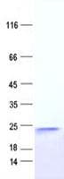 Human TNNC2 Protein (Recombinant DDK,C-terminus)