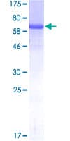 Human TIPIN Protein (Recombinant GST)