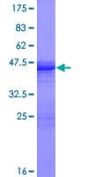 Human GCAP3 / GUCA1C Protein (Recombinant GST)