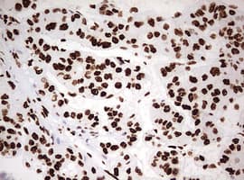 Monoclonal Mouse anti-Human HNRPM / HNRNPM Antibody (clone OTI3F3, aa1-261, IHC, WB)